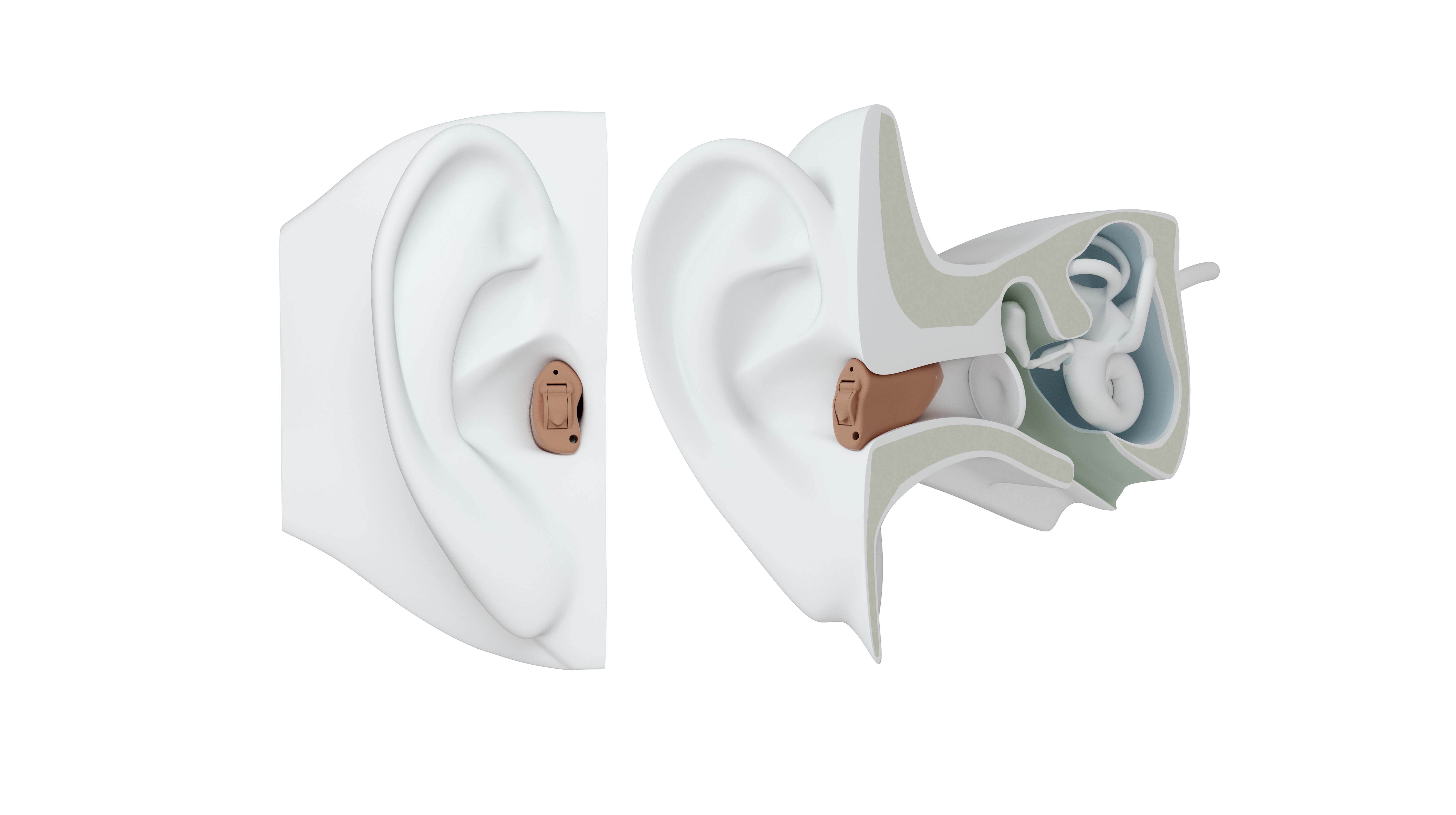 ReSound Custom (Kişiye Özel Kulak İçi) Detay